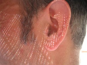 Sudden sensorineural hearing loss